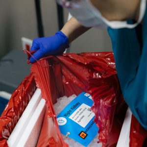 Read more about the article Organ Donation: What to Know About the Process